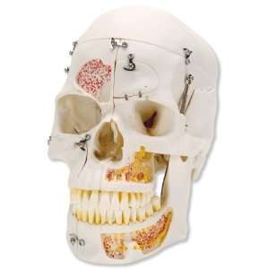  3B Scientific Deluxe Demonstration Skull Health 
