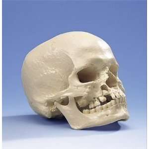  Microcephalic Human Skull