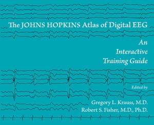 The Johns Hopkins Atlas of Digital EEG An Interactive Training Guide
