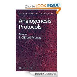 Angiogenesis Protocols (Methods in Molecular Medicine) (Methods in 