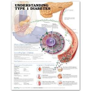 Understanding Type 1 Diabetes 2E Anatomical Chart  Plastic Laminated 