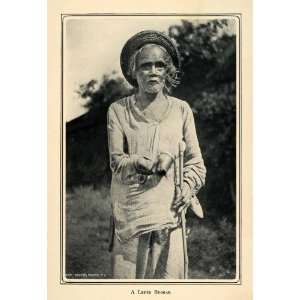  1905 Duotone Print Leper Beggar Filipino Philippines 